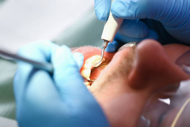 Best Emergency Dental Services for Seniors in Loch Sheldrake, NY